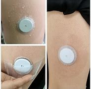 Image result for Freestyle Libre 2 Sensor Tape