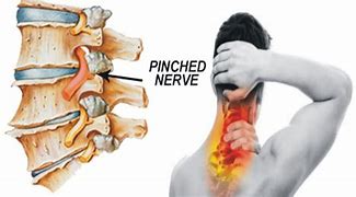 Image result for Pin Nerve Function