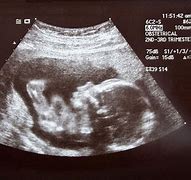 Image result for Ultrasound Image Gallery