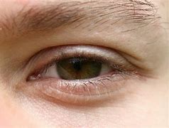 Image result for My Eye in Macro