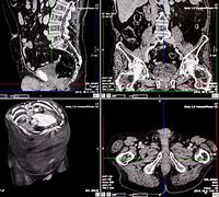 Image result for CT Scan Views