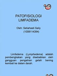 Image result for Patofisiologi Limfadenopati