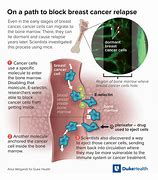 Image result for Cancer Bone Metastasis