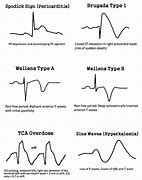 Image result for ECG Color