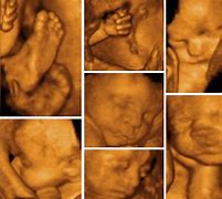 Image result for Mother 4D Baby Scan