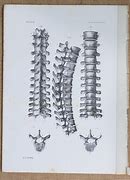 Image result for Dorsal Vertebrae