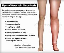 Image result for Thrombotic Veins