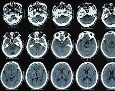 Image result for CT Scan Views