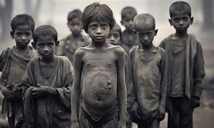 Image result for Starving Babies in Africa