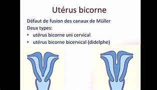 Image result for Bicorne