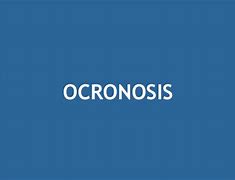 Image result for Que ES Ocronosis