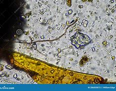 Image result for Fungal Hyphae in Soil