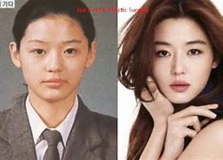 Image result for Jun Ji Hyun Plastic Surgery