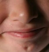 Image result for Dimples Near Chin