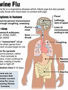 Image result for Swine Flu Rash