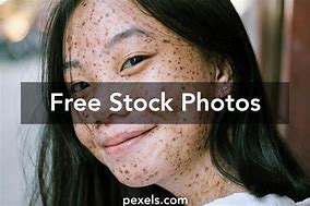 Image result for Pimple Face HD Images