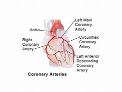 Image result for Angina Pectoris Anatomical Position