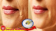 Image result for How to Remove Wrinkles around Mouth