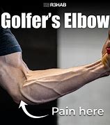 Image result for Rehab Golfers Elbow