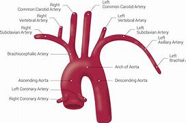 Image result for Aortic Vessels