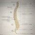 Image result for View of Spinal Column