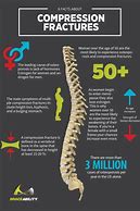 Image result for Compression Fracture Lumbar Surgery