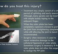 Image result for Dislocated PIP Joint in Pinky Finger