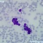 Image result for Adrenal Cytology