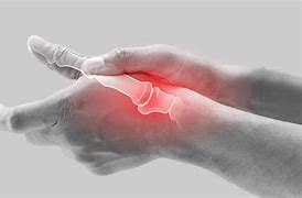 Image result for Pain in Wrist below Thumb