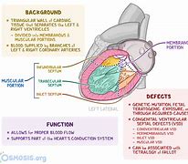 Image result for Myocardium of Interventricular Septum