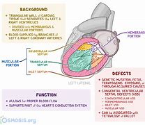 Image result for Interatrial Septum Formation