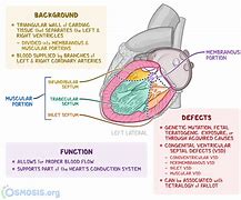 Image result for Interventricular Septum