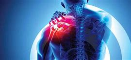 Image result for Arthritc Shoulder