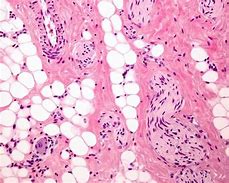 Image result for Human Tissue Acyt