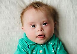 Image result for Down Syndrome Baby Pictures