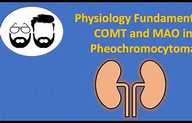 Image result for Pheochromocytoma Renin