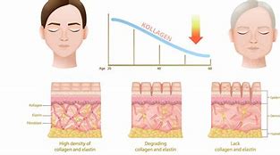 Image result for Atrophic Skin Aging