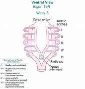 Image result for Aortic Vessels