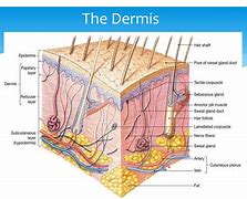 Image result for Dermis Skin Cut