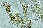 Image result for Stentor Protozoa