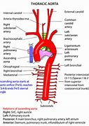 Image result for Aortic Vessels