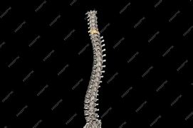 Image result for C6 Spinal