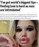 Image result for Lip Injection Memes