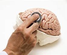 Image result for Brain Cancer Photo Human