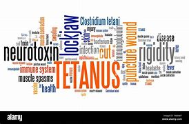 Image result for Tetanus Infected Wound