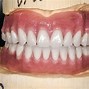 Image result for Bottom Dentures