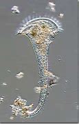 Image result for Stentor Protozoa