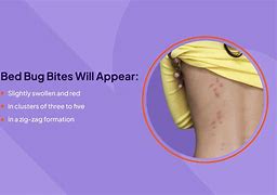 Image result for Bed Bug Bites Groin