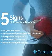 Image result for Colon Cancer Symptoms in Men Signs