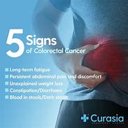 Image result for Colon Cancer Early Symptoms